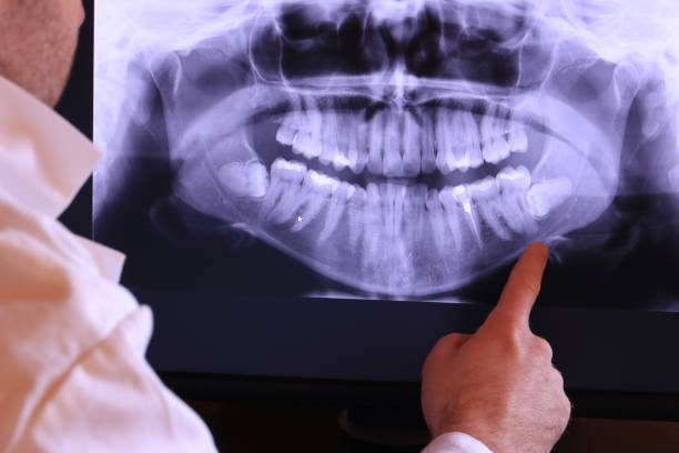 Best Emergency Treatment for Oral Infections in Bloomfield, IN