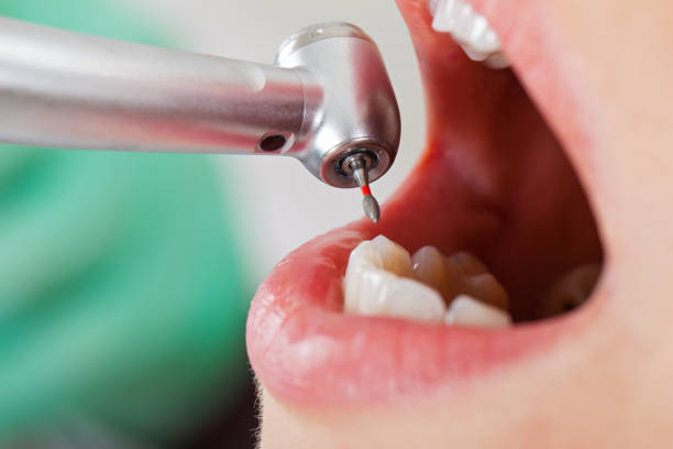 Best Emergency Treatment for Jaw Pain or Injury in Bloomfield, IN